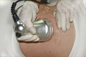 Dra Jenny Soto - Tratamiento de Ultracabitacion